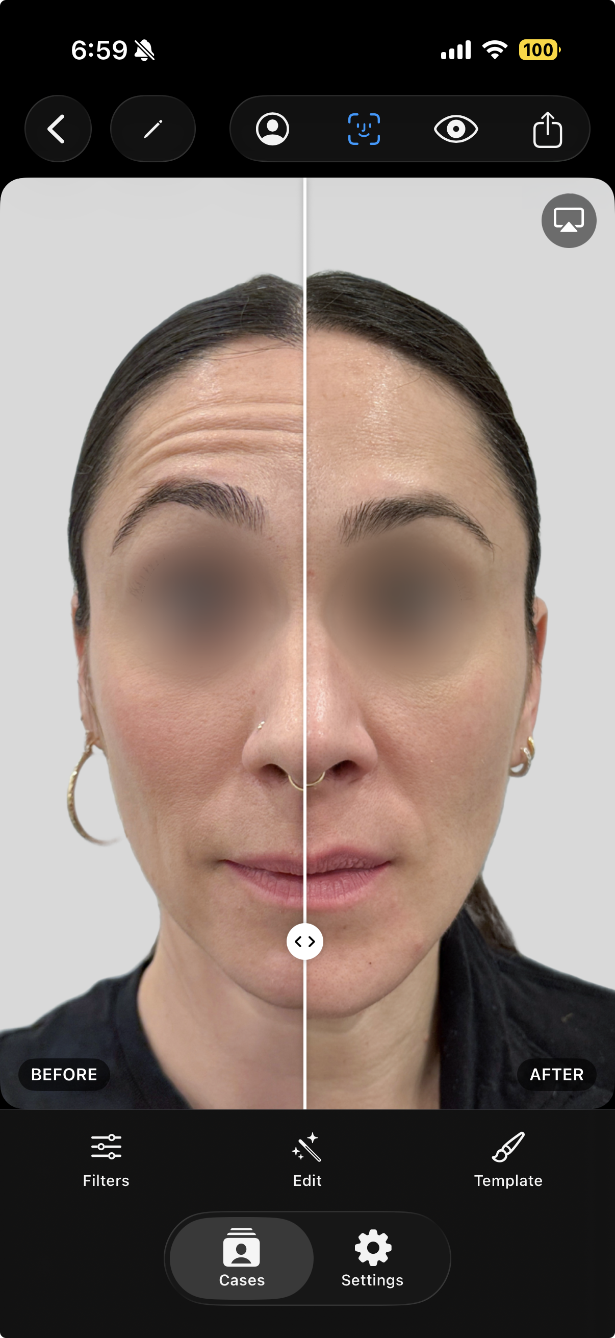 AI-aligned before and after slider comparison
